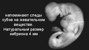 Рис. 5 Фотография эмбриона на стадии мудга (28-дневного). Эмбрион на этой стадии приобретает вид жевательного вещества из-за сомитов на спине эмбриона