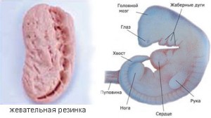 Рис. 6 Сравнивая вид эмбриона на стадии мудга с куском жвачки, которая была прожевана, мы находим схожесть с двумя.